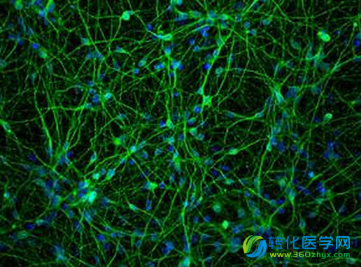 PLoS Genet：揭示调节大脑多巴胺水平的机制 或帮助开发治疗帕金森疾病的新型疗法
