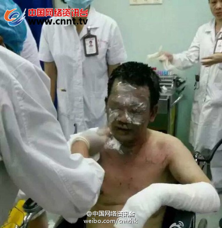 太反人性，广西医大一主任被患者泼汽油，重度烧伤！！！