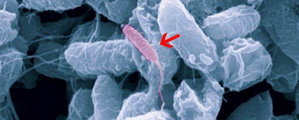 科学家在人唾液中发现了新的细菌 - 蛭弧菌