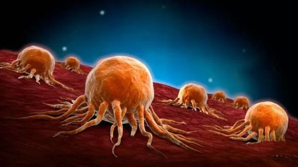 肿瘤是如何实现免疫逃逸的？