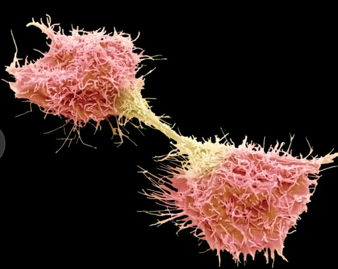 Nature发布癌症研究新发现：独一无二的基因特征