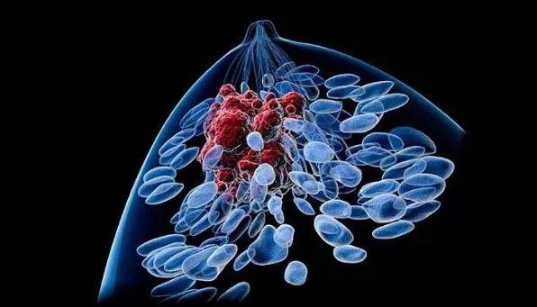 攻坚克难！中山大学谢新华团队发现“最毒”乳腺癌治疗新药