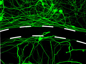 NIH：ISP能够穿透血脑屏障修复脊髓损伤细胞