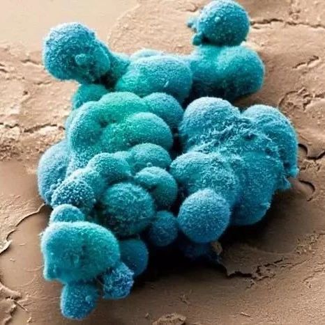 胰腺中的“微生物群”竟成胰腺癌“帮凶”
