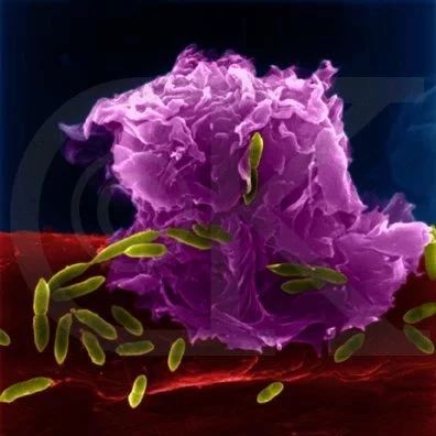 人体免疫细胞竟然促进肿瘤扩散？！《Nature》子刊解密巨噬细胞促癌作用！