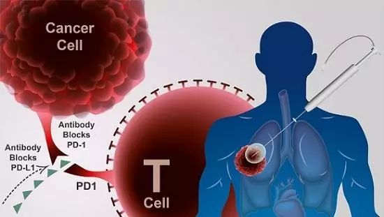 PD-1抗体药物genolimzumab直击实体瘤，CBT制药公司进行1期临床试验