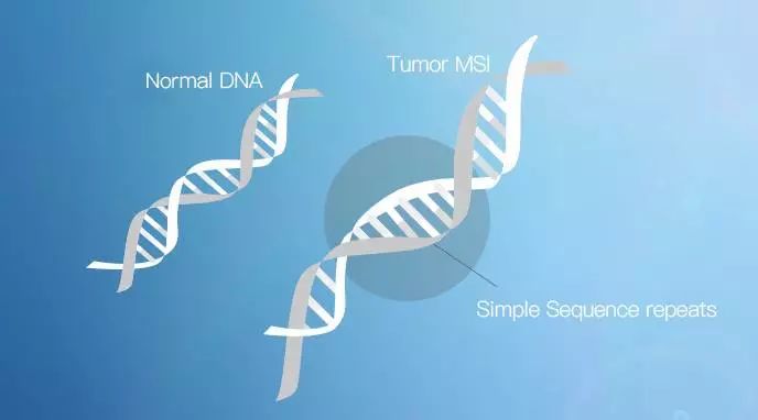 微卫星不稳定与结直肠癌：不论类型，均需考虑做MSI或MMR检测