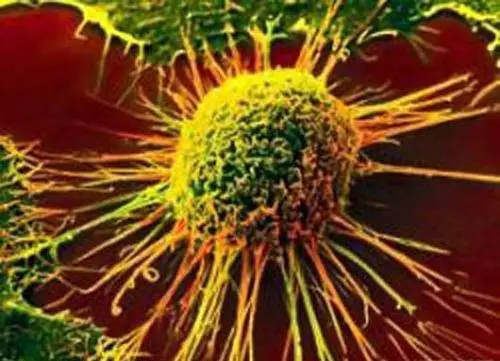 Nature：告别脑癌！新型T细胞突破血脑屏障，成功归巢脑肿瘤！