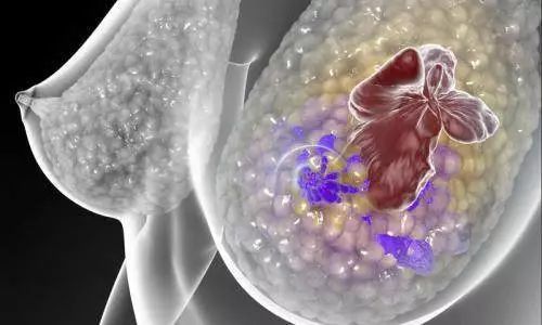 这些被忽视的免疫细胞，竟是乳腺癌细胞治疗的“潜力股”！