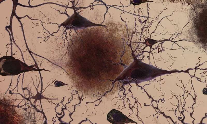 【Nature】阿尔茨海默病患者脑脊液惊现免疫T细胞！