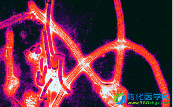 美专家称抗击埃博拉正陷入“五个误区”