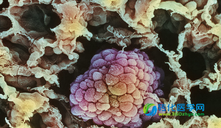 I-II 期非小细胞肺癌患者 术后化疗不能改善预后