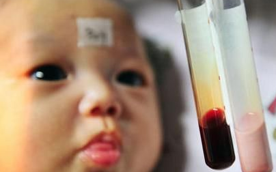 【乳白色血液怪病】药明康德将为信阳婴儿患者进行基因检测
