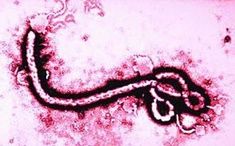 埃博拉攻入亚洲！印度发现首例病例