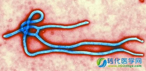 埃博拉病毒肆虐西非的真正原因