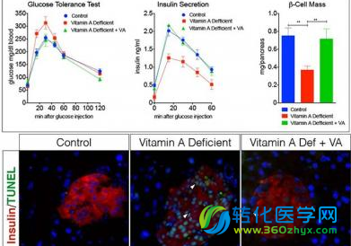 维生素A缺乏容易引发2型糖尿病