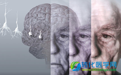 维持神经受体稳定性或助治疗阿尔兹海默症