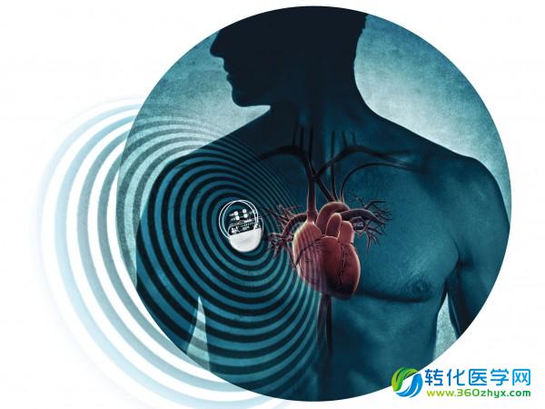 隐患：黑客可通过无线控制你的心脏起搏器？