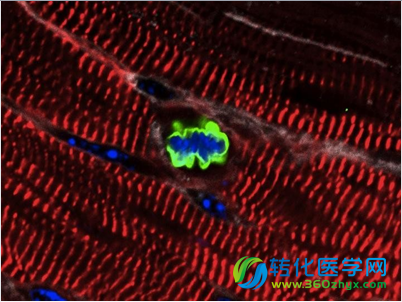 一种光动力疗法或可使胰腺癌治疗变得简单化