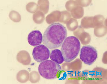 Science：潜在化合物或可成为治疗白血病的疗法“新范式”