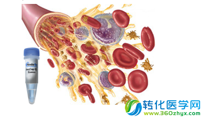 系统性的编码突变分析发现影响总胆固醇及心肌梗死风险的新基因TM6SF2 