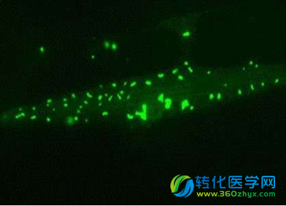 Cell：颠覆细胞中有害蛋白聚集物避免神经性疾病发生