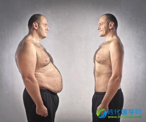 研究发现肥胖或增男性乳腺癌风险