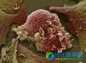 Nature提出细胞自毁新学说