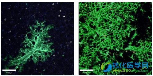 利用干细胞移植来治愈损伤的肺部组织