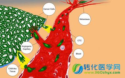 研究发现一种新药物可通过排除铜预防肿瘤转移