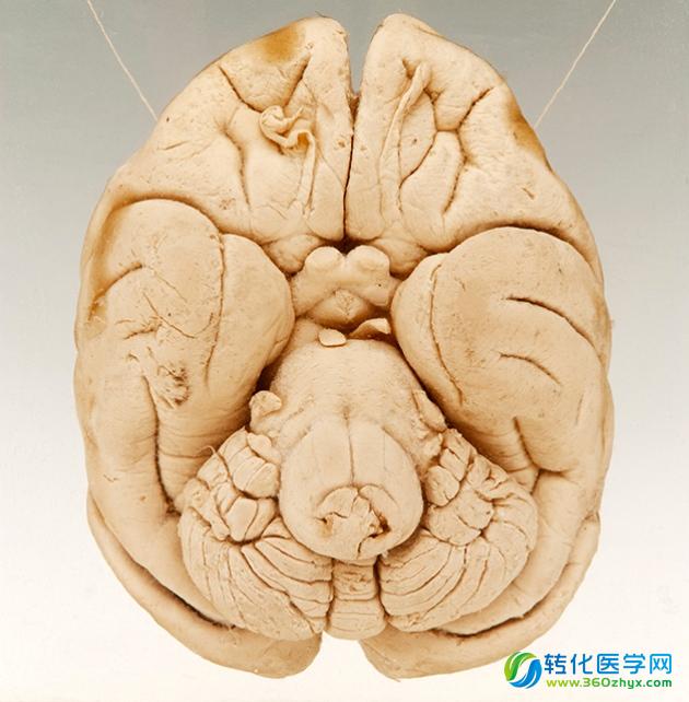 科学家可能发现，造成人不同于猩猩的大脑区域