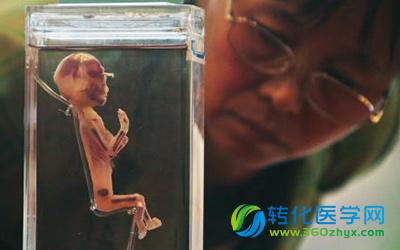 PLOS ONE：由干细胞分化得到的类器官