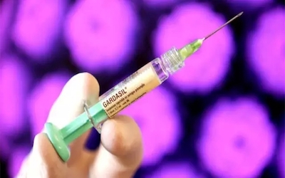 接种HPV疫苗可减少子宫颈癌筛查