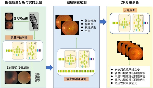 【科研转化】贾伟平教授团队研发人工智能系统DeepDR 精准识别糖尿病视网膜病变