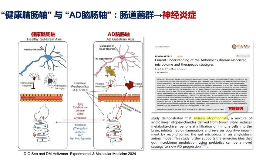 治疗阿尔茨海默病国产新药断货与思考