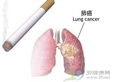 “血液活检”可追踪小细胞肺癌？