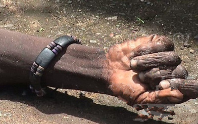 一名埃博拉患者复活 曾躺在街头数日未动