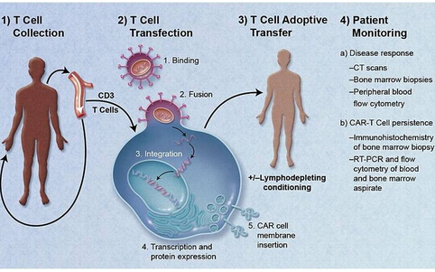 CAR-T疗法：美药企开始招募一期临床病人
