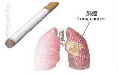 吸烟者肺癌发病率是不吸烟者28倍