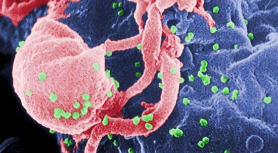 剪掉HIV病毒基因 根治艾滋病