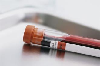 Sci Trans Med：血液检测可预测乳腺癌药物抵抗