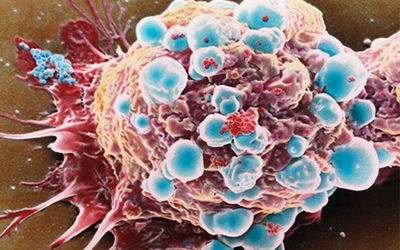 【干货】2016最新癌症免疫治疗技术及市场分析