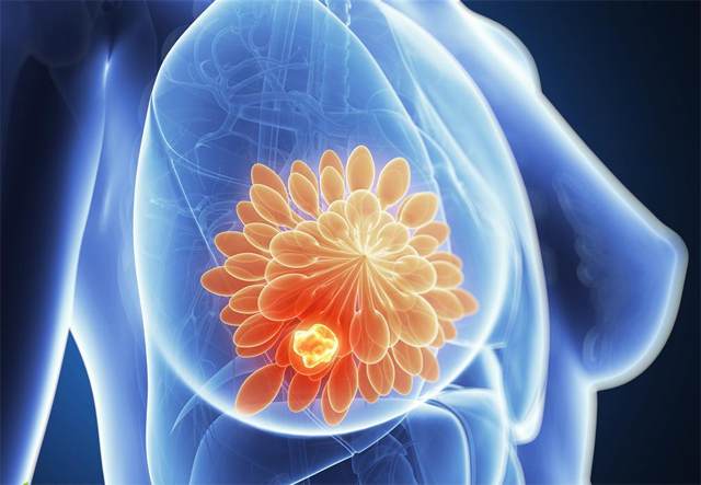 英科学家称新药物或将治愈晚期乳腺癌