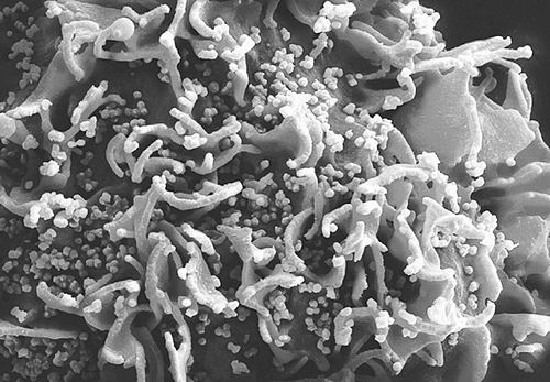 艾滋病病毒不惧“基因剪刀CRISPR”