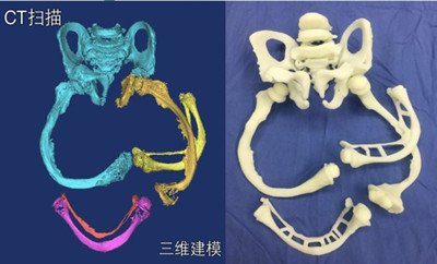 科学家尝试产前干细胞疗法拯救患病胎儿