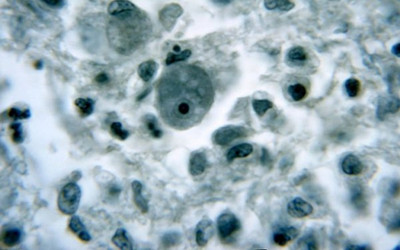 PNAS：“不干不净不生病”有科学证据