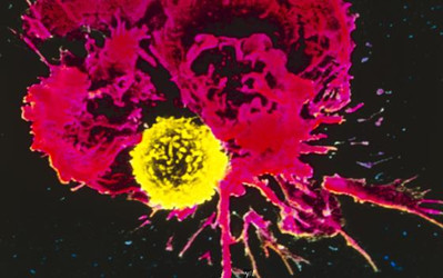 PNAS：用致命毒素治疗癌症