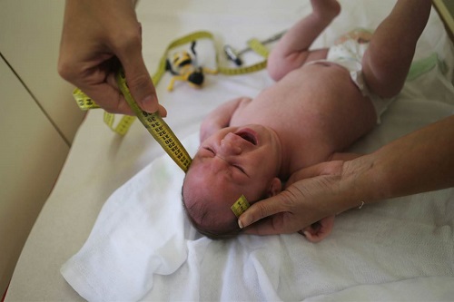 欧洲出现首例因寨卡病毒导致的小头症婴儿