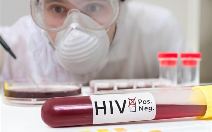 产生HIV抗体的人群具备与众不同的强大其免疫特性