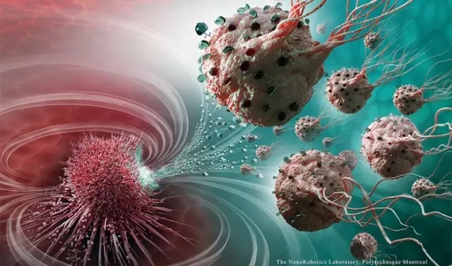 MC-1(T)趋磁球菌“生物导弹”，精准锁定攻击癌细胞